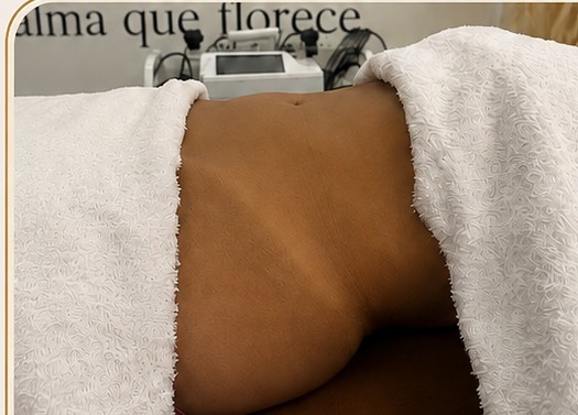Antes del moldeo corporal y tonificación en ALMA Wellness Center